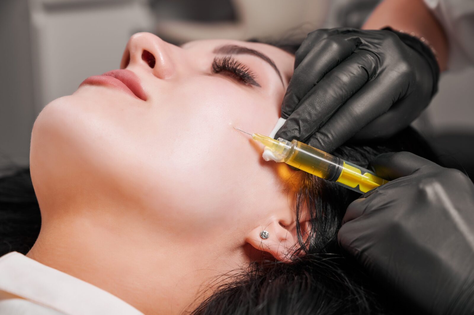 Close-up of plasmolifting procedure injection. Doctor cosmetologist beautician in black sterile gloves making injection in female patient face. Concept of skincare treatment.